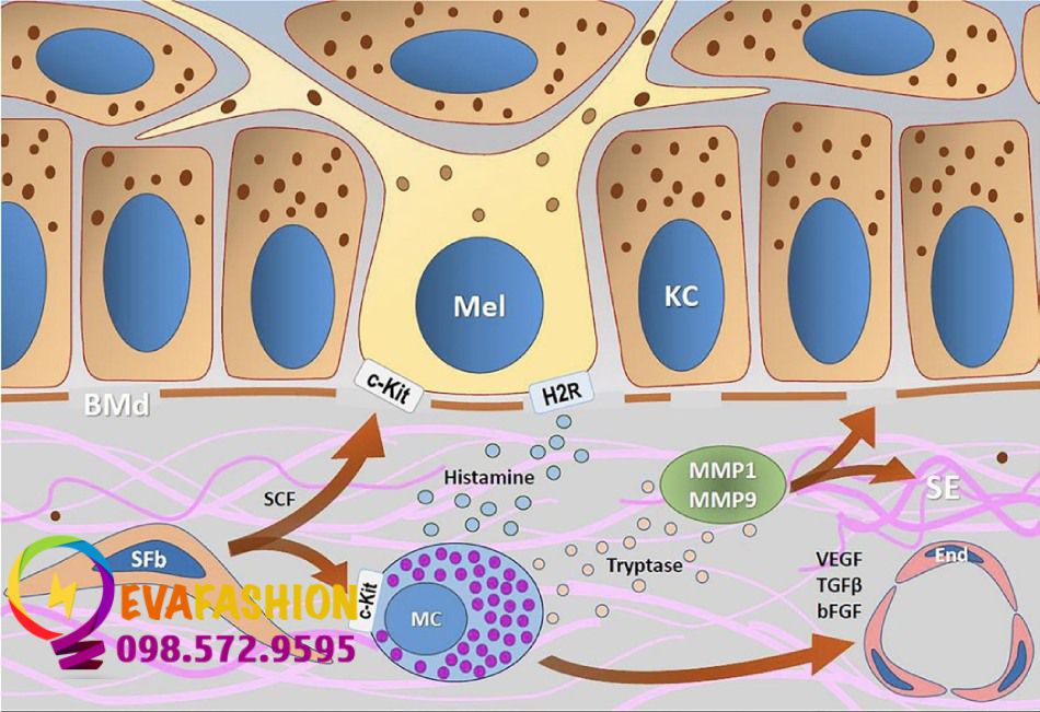 Hình 6. Sơ đồ biểu diễn sự tương tác giữa nguyên bào sợi lão hóa (SFbs) và tế bào mast (MC) trong nám da.